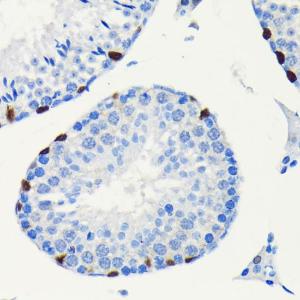 Immunohistochemistry analysis of paraffin-embedded mouse testis using Anti-SOX9 Antibody [ARC0190] (A306215) at a dilution of 1:100 (40x lens). Perform microwave antigen retrieval with 10 mM PBS buffer pH 7.2 before commencing with IHC staining protocol