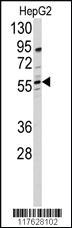 Anti-DHCR24 Rabbit Polyclonal Antibody