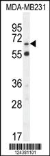 Anti-S6A12 Rabbit Polyclonal Antibody