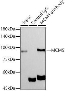 Immunoprecipitation analysis of 300µg extracts of MCF7 cells using 3µg of Anti-MCM5 Antibody [ARC1239] (A305293). This Western blot was performed on the immunoprecipitate using Anti-MCM5 Antibody [ARC1239] (A305293) at a dilution of 1:1000.