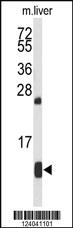 Anti-HBA2 Rabbit Polyclonal Antibody