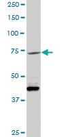 Anti-VCAM1 Rabbit Polyclonal Antibody