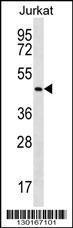 Anti-MAPK14 Rabbit Polyclonal Antibody (APC (Allophycocyanin))