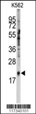 Anti-SNRPC Rabbit Polyclonal Antibody