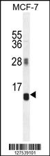 Anti-AVPI1 Rabbit Polyclonal Antibody