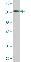 Anti-PSMD5 Mouse Monoclonal Antibody [clone: 1H7]