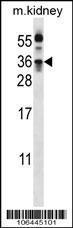 Anti-KLK8 Rabbit Polyclonal Antibody (PE (Phycoerythrin))