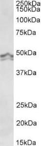 Anti-HRH3 Antibody (A85077) (0.1µg/ml) staining of A549 lysate (35µg protein in RIPA buffer). Primary incubation was 1 hour. Detected by chemiluminescence.