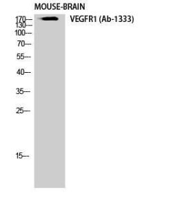 Anti-VEGFR 1+VEGFR 2 Rabbit Polyclonal Antibody