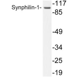 Antibody anti-synphilin-1 100 µg