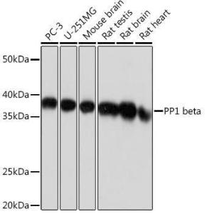 Western blot analysis of extracts of various cell lines, using Anti-PPP1CB Antibody [ARC0981] (A305294) at 1:1000 dilution