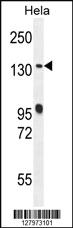 Anti-DEN5A Rabbit Polyclonal Antibody