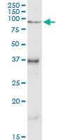 Anti-VCAM1 Rabbit Polyclonal Antibody