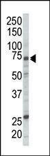 Anti-RAF1 Rabbit Polyclonal Antibody (AP (Alkaline Phosphatase))