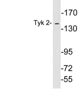 Antibody anti-TYK 2 100 µg