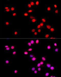 Immunofluorescence analysis of NIH/3T3 cells using Anti-SOX9 Antibody [ARC0190] (A306215) at a dilution of 1:50 (40x lens). DAPI was used to stain the cell nuclei (blue)