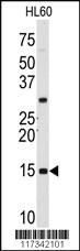 Anti-SNRPD1 Rabbit Polyclonal Antibody