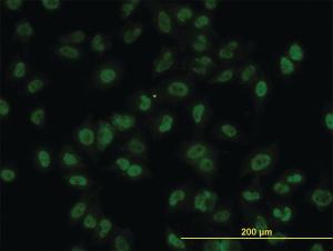 Anti-AKT2 Mouse Monoclonal Antibody [clone: 1B3]