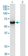 Anti-CAMKK1 Mouse Monoclonal Antibody [clone: 3B4]