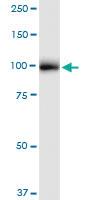 Anti-GANAB Rabbit Polyclonal Antibody