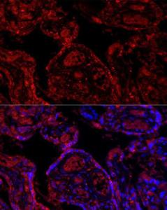 Immunofluorescence analysis of human placenta cells using Anti-PD-L1 Antibody (A8949) at a dilution of 1:200 (40x lens) DAPI was used to stain the cell nuclei (blue)