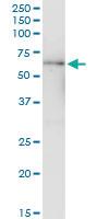 Anti-MYC Antibody Pair