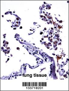 Anti-IL13 Rabbit Polyclonal Antibody (FITC (Fluorescein Isothiocyanate))