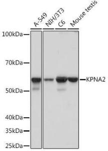 Anti-KPNA2 Rabbit Monoclonal Antibody [clone: ARC1227]