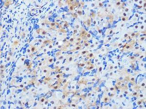 Immunohistochemistry analysis of paraffin-embedded rat ovary using Anti-PPP1CB Antibody [ARC0981] (A305294) at a dilution of 1:100 (40x lens). Perform microwave antigen retrieval with 10 mM PBS buffer pH 7.2 before commencing with IHC staining protocol