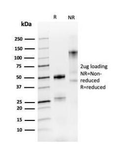 SDS-PAGE analysis of Anti-PAX8 Antibody [PAX8/3688R] under non-reduced and reduced conditions; showing intact IgG and intact heavy and light chains, respectively. SDS-PAGE analysis confirms the integrity and purity of the antibody.