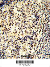 Anti-SNRPD1 Rabbit Polyclonal Antibody