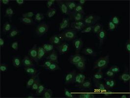 Anti-AKT2 Mouse Monoclonal Antibody [clone: 1B3]