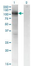 Anti-VCAM1 Mouse Monoclonal Antibody [clone: 1H6]