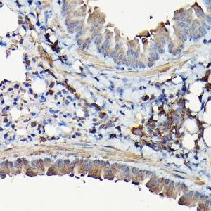 Immunohistochemistry analysis of paraffin-embedded mouse lung using Anti-YAP1 Antibody (A93149) at a dilution of 1:100 (40X lens). Perform high pressure antigen retrieval with 10 mM citrate buffer pH 6.0 before commencing with IHC staining protocol