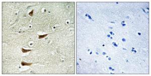 Antibody anti-MAP3K10 100 µg