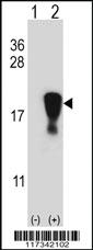 Anti-SNRPD1 Rabbit Polyclonal Antibody