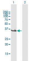 Anti-LCMT1 Rabbit Polyclonal Antibody