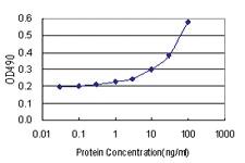 Anti-SNAI1 Antibody Pair