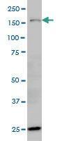 Anti-HYOU1 Mouse Monoclonal Antibody [clone: 6F7]