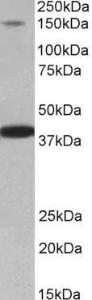 Antibody anti-IRS4 100 µg