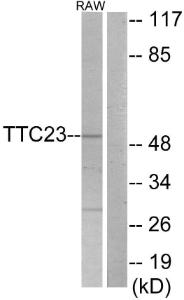 Anti-TTC23 antibody