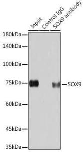 Immunoprecipitation analysis of 200 µg extracts of HeLa cells using 3 µg of Anti-SOX9 Antibody [ARC0190] (A306215). This Western blot was performed on the immunoprecipitate using Anti-SOX9 Antibody [ARC0190] (A306215) at a dilution of 1:1000