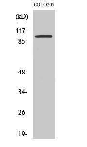 Antibody anti-synphilin-1 100 µg