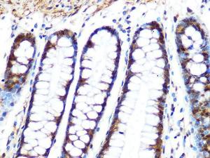 Immunohistochemistry analysis of paraffin-embedded human colon tissue using Anti-PPP1CB Antibody [ARC0981] (A305294) at a dilution of 1:100 (40x lens)