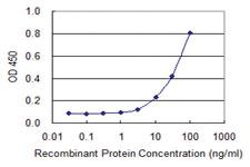 Anti-VCAM1 Mouse Monoclonal Antibody [clone: 1H6]