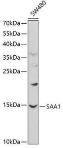 Western blot analysis of extracts of SW480 cells, using Anti-Serum Amyloid A Antibody (A8951) at 1:1,000 dilution