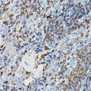 Immunohistochemistry analysis of paraffin-embedded rat spleen using Anti-YAP1 Antibody (A93149) at a dilution of 1:100 (40X lens). Perform high pressure antigen retrieval with 10 mM citrate buffer pH 6.0 before commencing with IHC staining protocol