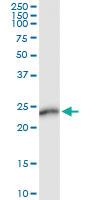 Anti-AMELX Polyclonal Antibody Pair