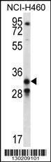 Anti-GDF15 Rabbit Polyclonal Antibody (HRP (Horseradish Peroxidase))