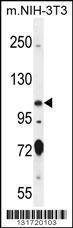 Anti-SPECC1 Rabbit Polyclonal Antibody (HRP (Horseradish Peroxidase))